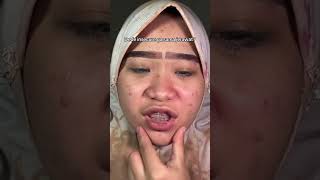 NOCP #skincare #skincare #krimpemutihwajah #skincareroutine #serumwajahalami #haircare #perawatanwa