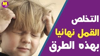طرق ازالة القمل والصيبان من الشعر عند الاطفال