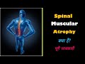 What is Spinal Muscular Atrophy With Full Information? – [Hindi] – Quick Support