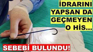 Sürekli İdrar Hissi Yaşayanlar İçin Etkili Bir Yöntem Mesane Fulgurasyonu