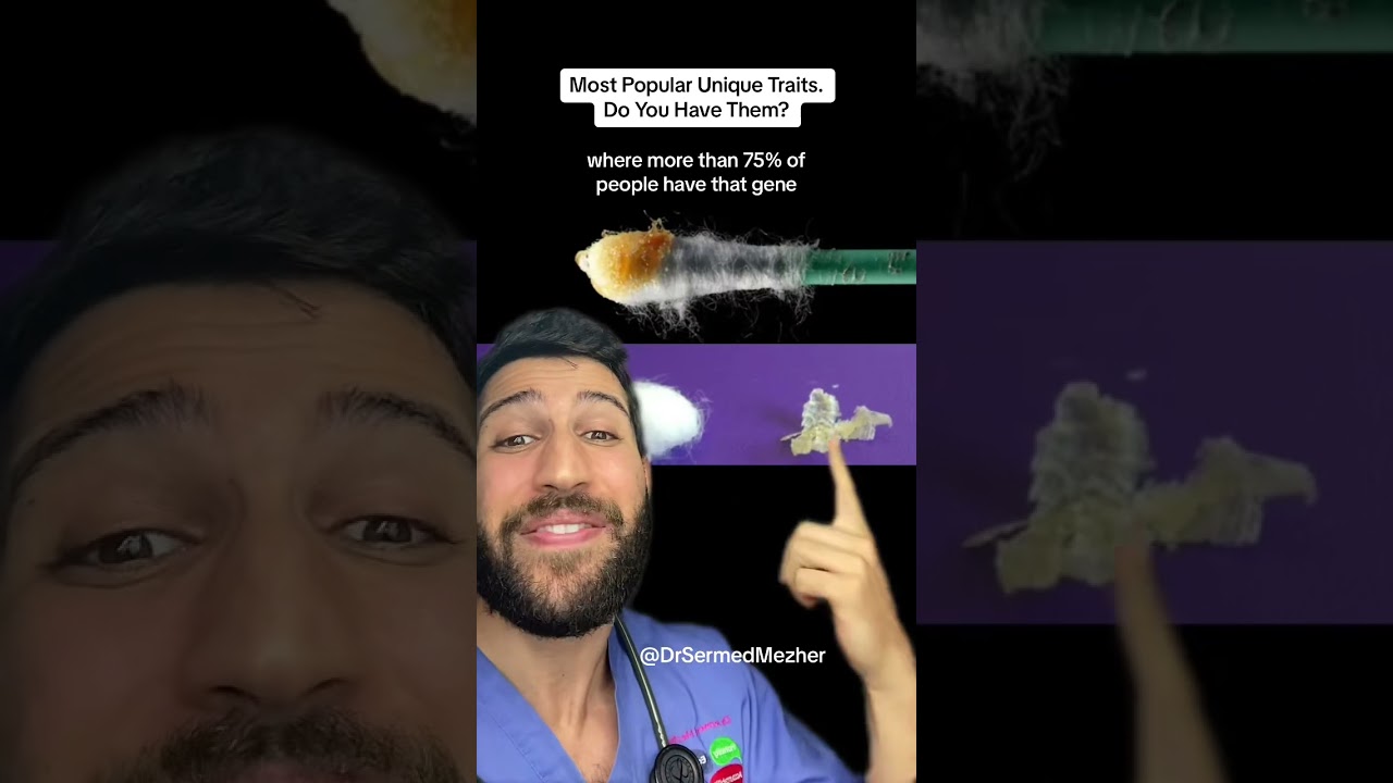 Most Popular Unique Traits, Do You Have Them? 