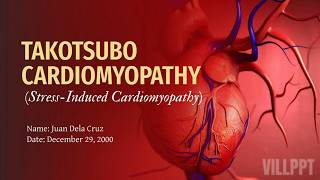 Medical Case Study Presentation | Takotsubo Cardiomyopathy | Canva PowerPoint Presentation