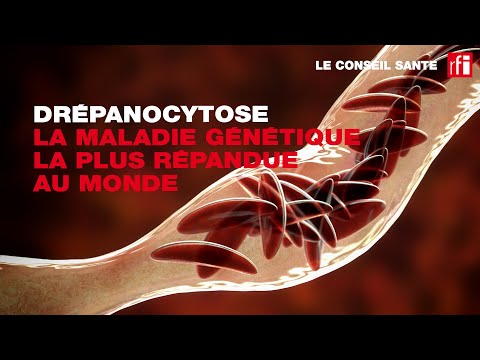 Vidéo: Comment reconnaître les symptômes de la drépanocytose (SCD)