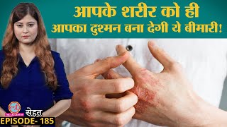 क्यों हो जाती हैं Autoimmune diseases जिसमें अपनी Immunity दुश्मन बन जाती है | Sehat ep 185 screenshot 3