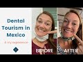 Getting Dental Work Done in Mexico | Dental Tourism Tips