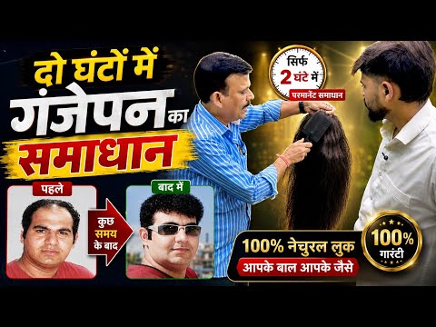 दो घंटों में गंजेपन का खेल खत्म | 100% नेचुरल बाल | Hi handsome hair Wing | Desi platform | 