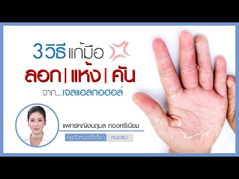 วีดีโอ: 3 วิธีรักษามือแห้ง