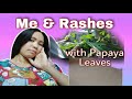 Ganito Ginawa Nung Naisip Na Baka Dengue Nga Sya | How To Take Papaya Leaves | Melgabar Je Vlog