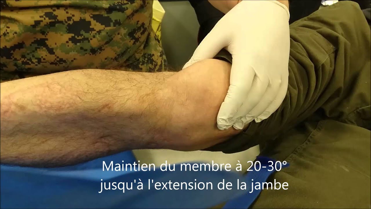 reduction de luxation de rotule - YouTube