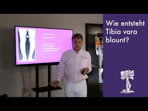 Video: Wie häufig ist die Blount-Krankheit?