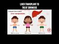 Liver transplant to treat cirrhosis #livertreatment #livercirrhosis #transplants #transplantsurgery