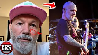Famous Fred Durst’s Emotional & tearful Tribute to Sam Rivers – Remembering the Bassist of Limp Bizkit 😭 Net Worth