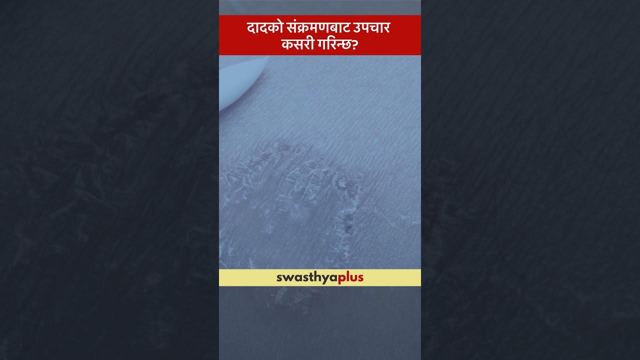 दादको संक्रमणबाट उपचार कसरी गरिन्छ? | Ringworm Infection: How to treat? | Dr Pravin Baniya | 