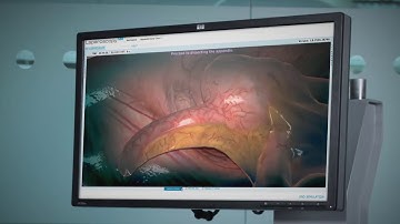 LapVR Simulateur Chirurgical par CAE Healthcare
