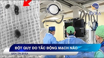ĐỘT QUỴ DO TẮC ĐỘNG MẠCH NÃO