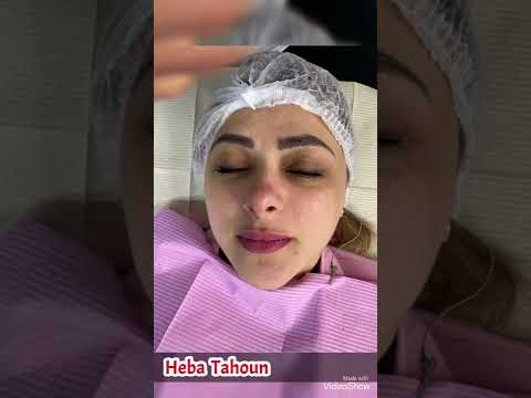 جلسه تنظيف بشره بالهايدرافيشيال