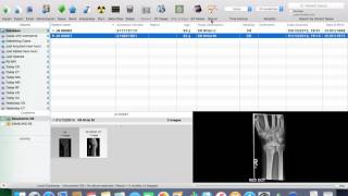 3  How to add a report to a Osirix study screenshot 4