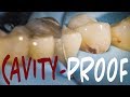 HOW TO PREVENT CAVITIES: Cavity / Tooth Decay Prevention 101