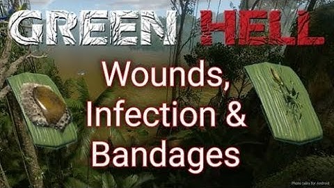Wounds, Infection and Bandages | Green Hell