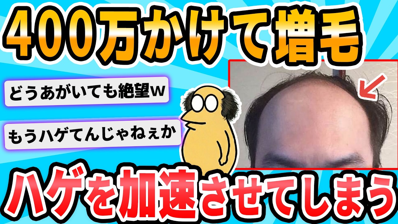 【2ch面白いスレ】アデランスに騙されて増毛した結果