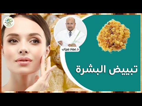 وصفات لبان الذكر لتبييض البشرة والتخلص من الكلف   