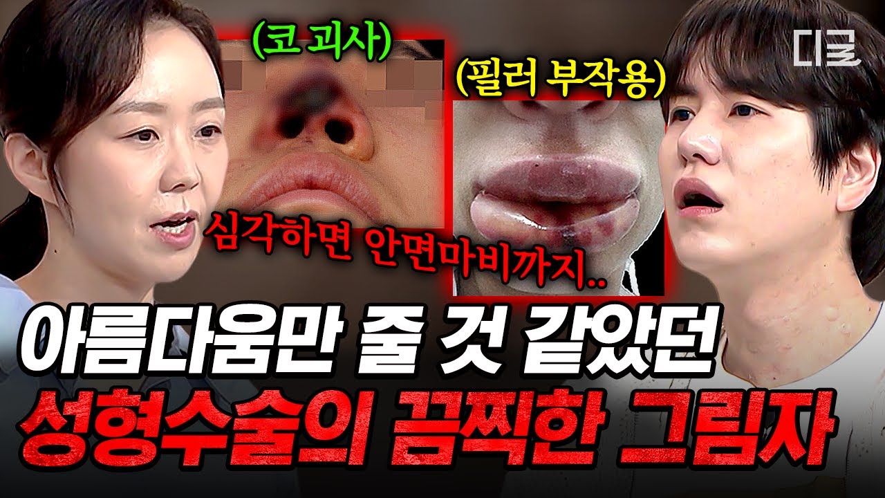 [#벌거벗은세계사] 보톡스는 독이다?💥 필러, 보톡스 등 젊음을 되찾는 수술/시술의 부작용