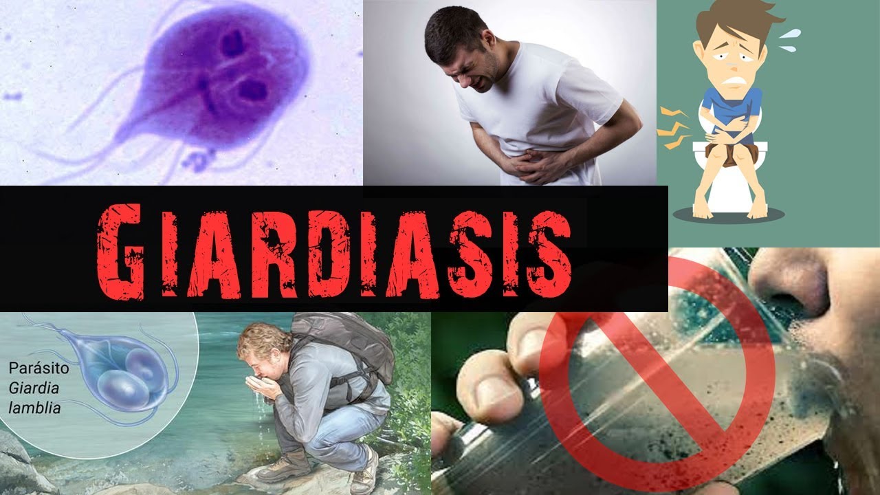 a giardiasis parazita tünetei)