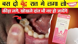 Stolin Gum Astringen /सिर्फ 1 बार लगाएं – दांत का कीड़ा, दर्द और मसूड़ों की सूजन जड़ से खत्म
