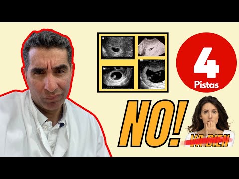 🤷‍♀️Cómo es un #embarazo no evolutivo: 4 señales⭐  ✅Dr. Felix Lugo 🥇😀