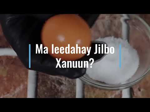 Jilbo Xanuun maxaa lagu daweeyaa?