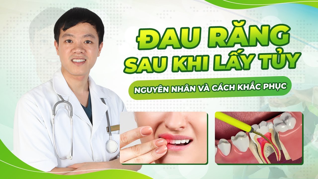 Outline Video Tại Sao Lấy Tủy Răng Rồi Nhưng Răng Vẫn Đau? Nguyên Nhân Gây Đau Sau Khi Điều Trị Tủy Là Gì?