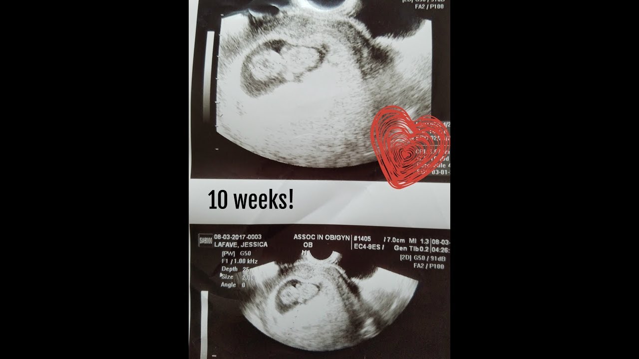BAKING SODA GENDER TEST 10 WEEK PREGNANCY UPDATE YouTube