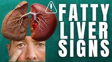 Fatty Liver Unveiled: Signs You Can
