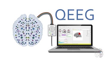 QEEG Explained - How Does A QEEG Brain Scan Work?
