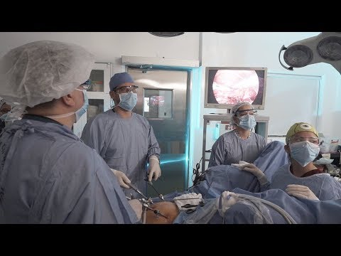 Video: ¿Qué es la salpingectomía bilateral laparoscópica?