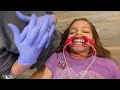 Getting my braces 😁 at 8 years old ~braces to fix my crossbite