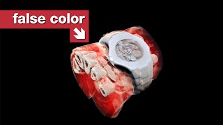 The first 3D color X-rays