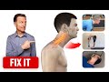Correct Forward Head Posture with 3 Things - Dr. Berg