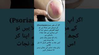 Psoriasis treatment psoriasis feedshorts virelshorts shortsfeed