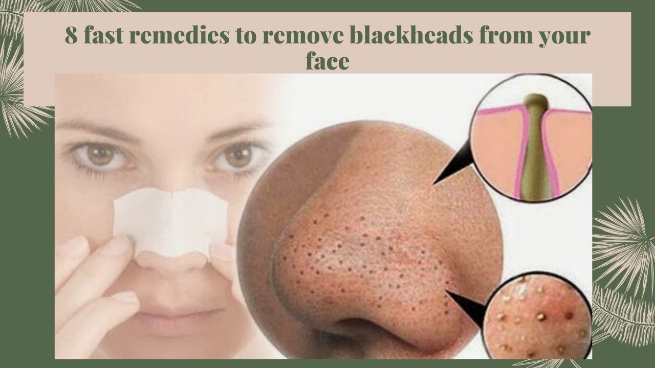Do THIS to Remove Blackheads From Your Nose - YouTube