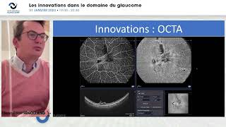 Innovations dans l’imagerie Pr Jean-Rémi FÉNOLLAND