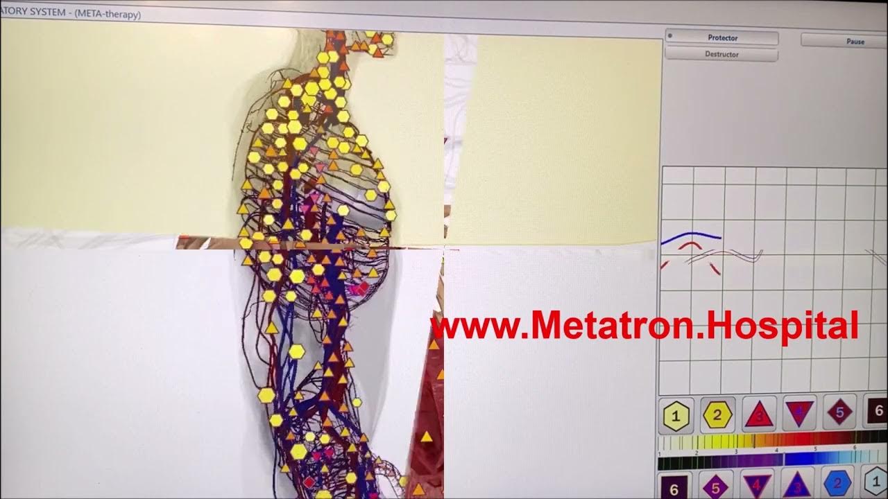 Computer Aided Health Check Metatron Hospital 3D NLS Analyzer System Hi ...