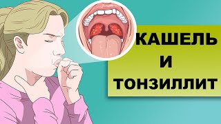 ТОНЗИЛИТНЫЙ КАШЕЛЬ. Кашель при хроническом тонзиллите