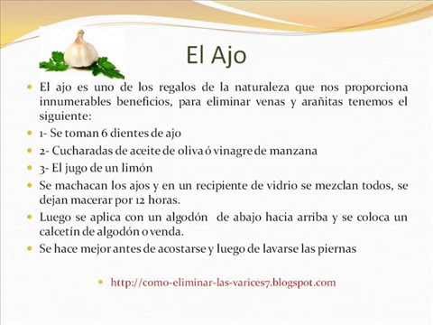 Como quitar las varices rapido