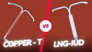 Copper T vs LNG IUD for Loksewa Entrance MBBS/MD/MS and PSC in Nepal how long does copper t work