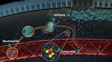 Neutrophils and Neutrophil Extracellular Traps (NETs) in IBD | Serum Calprotectin CPa9-HNE Biomarker