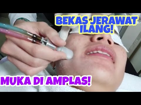 Tetangga Kaget!! Wajah Putih Mulus Tanpa Flek Hitam Seperti  Perawatan Klinik Kecantikan!!. 