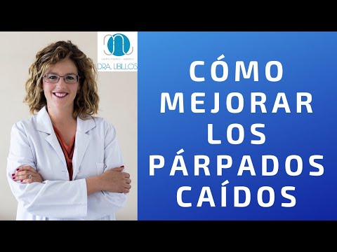 Vídeo: Párpado Caído Después De Botox: Causas Y Tratamiento