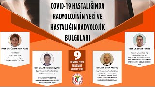 WEBİNAR | COVID-19 HASTALIĞINDA RADYOLOJİNİN YERİ VE HASTALIĞIN RADYOLOJİK BULGULARI