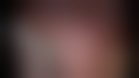 Difficult lap appendectomy retrocolic sub hepatic perforated appendix